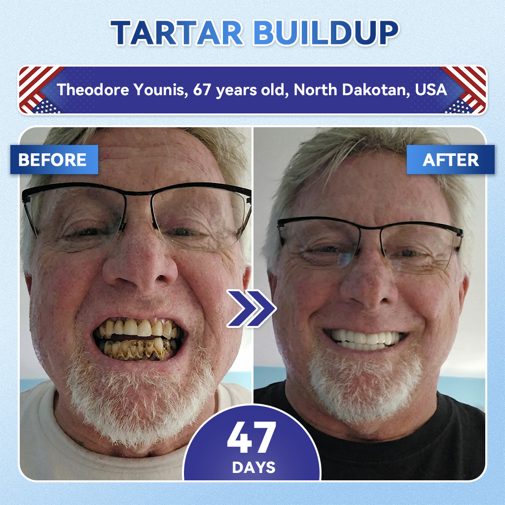 🦷 Tideglusib snabbupplösande orala remsor för reparation av tänder och tandkött✨