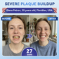 🦷 Tideglusib snabbupplösande orala remsor för reparation av tänder och tandkött✨