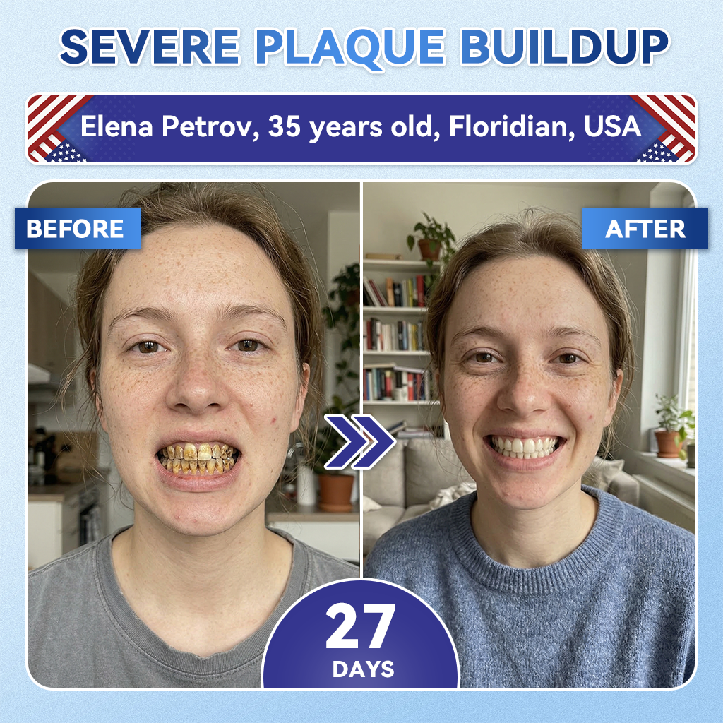🦷 Tideglusib snabbupplösande orala remsor för reparation av tänder och tandkött✨
