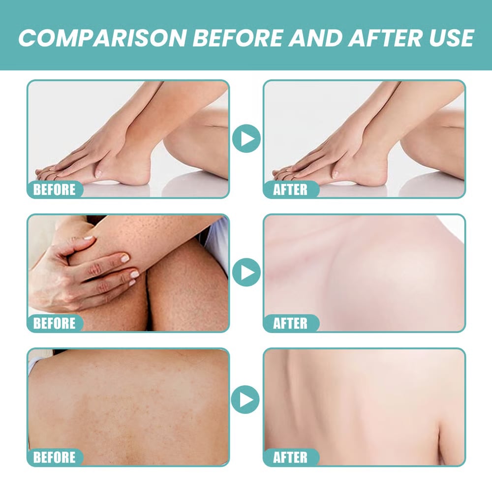 2026 Nyhet-✨ Skin So Soft Original Bath Oil – Silkeslen hud & naturligt skydd mot flugor och mygg för människor och husdjur 🛁🐴