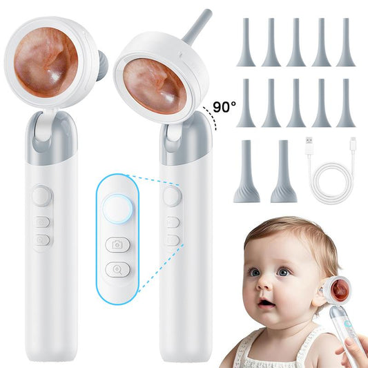 Aspoven Digital Otoskop 2026 – LED, 1,4″ IPS-skärm, 1080p HD, För barn, vuxna och husdjur, 12 silikontips, USB-C uppladdningsbar