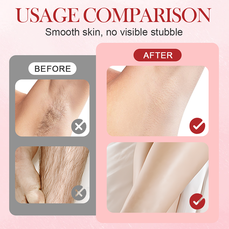🔥HET REA🔥Bärbar elektrisk epilator med dubbla huvuden🍑