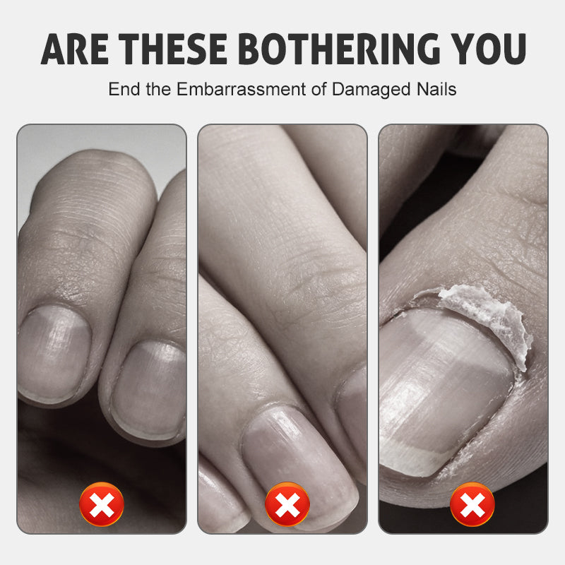 Nagelvårdsspray för Reparation & Styrka