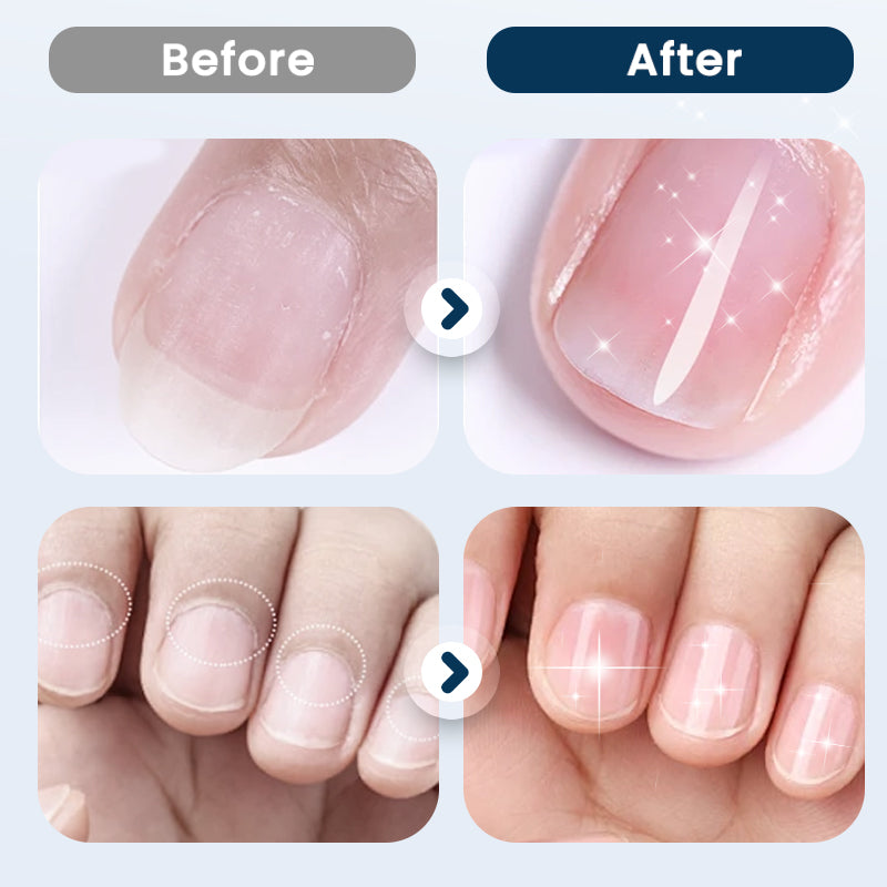 Nagelvårdsspray för Reparation & Styrka