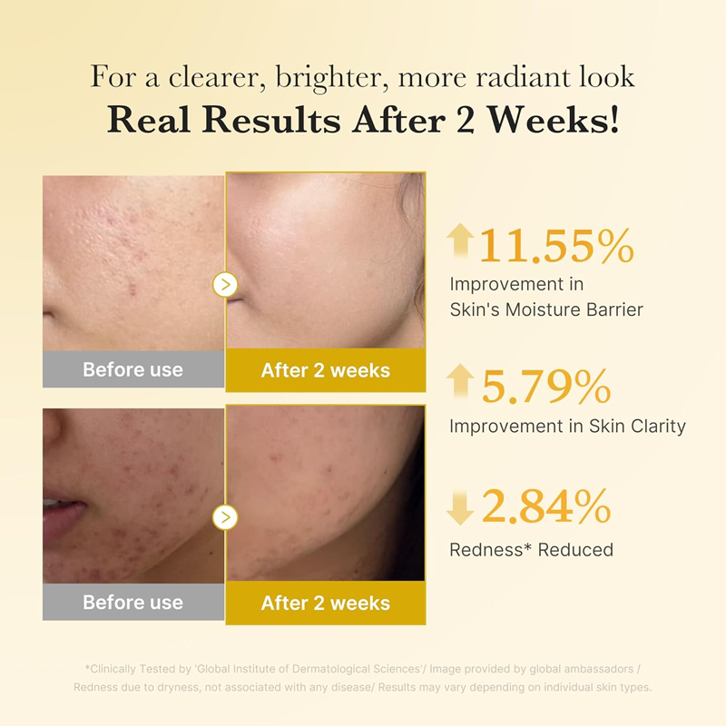 ✨ 50% RABATT NU! Kojic Acid Turmeric Brightening Serum – ljusnar, lugnar, jämnar ut hudtonen & stärker fuktbarriären 🌿💛